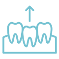 Teeth-Extractions