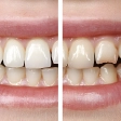 before-after-image before-after-image