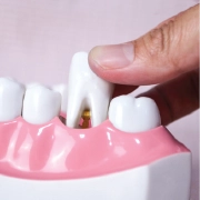 Dentist gently performing a tooth extraction.